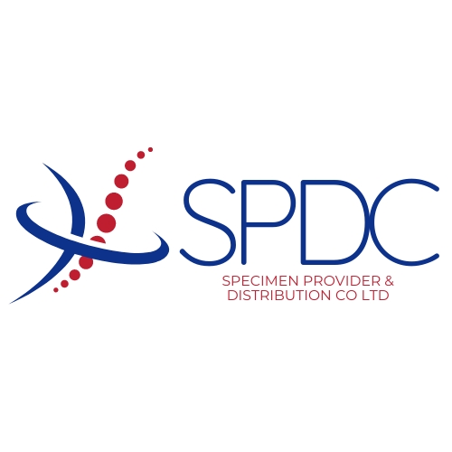SPDC